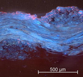 Understanding water uptake, gradient formation and material transport in canvas paintings